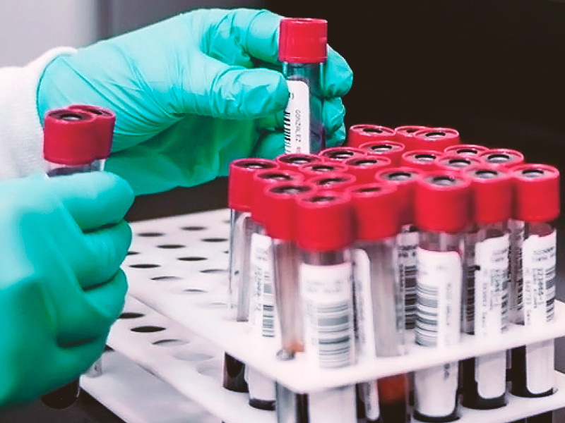 Сроки выведения марихуаны из организма Сроки выведения конопли из организма